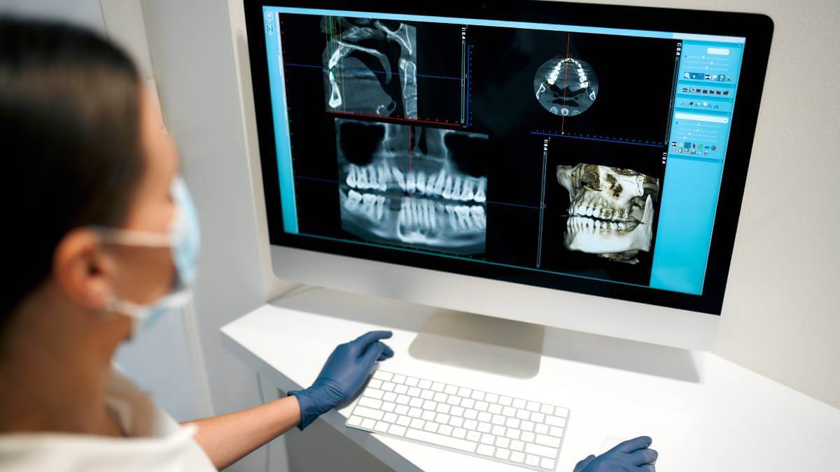 A close up picture of a computer screen showing teeth x-rays