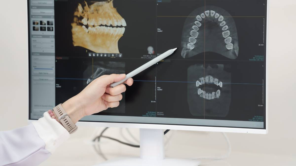 A picture of someone pointing at a computer screen showing mouth x-rays