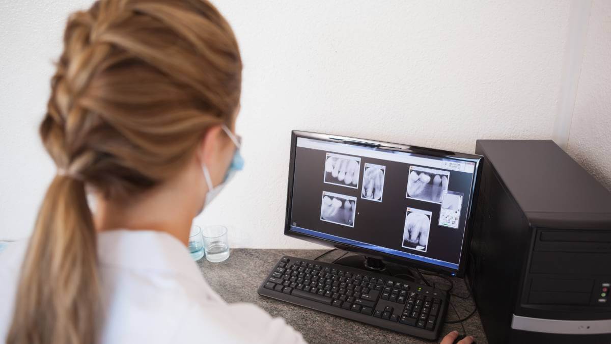 Teeth x-rays on computer screen
