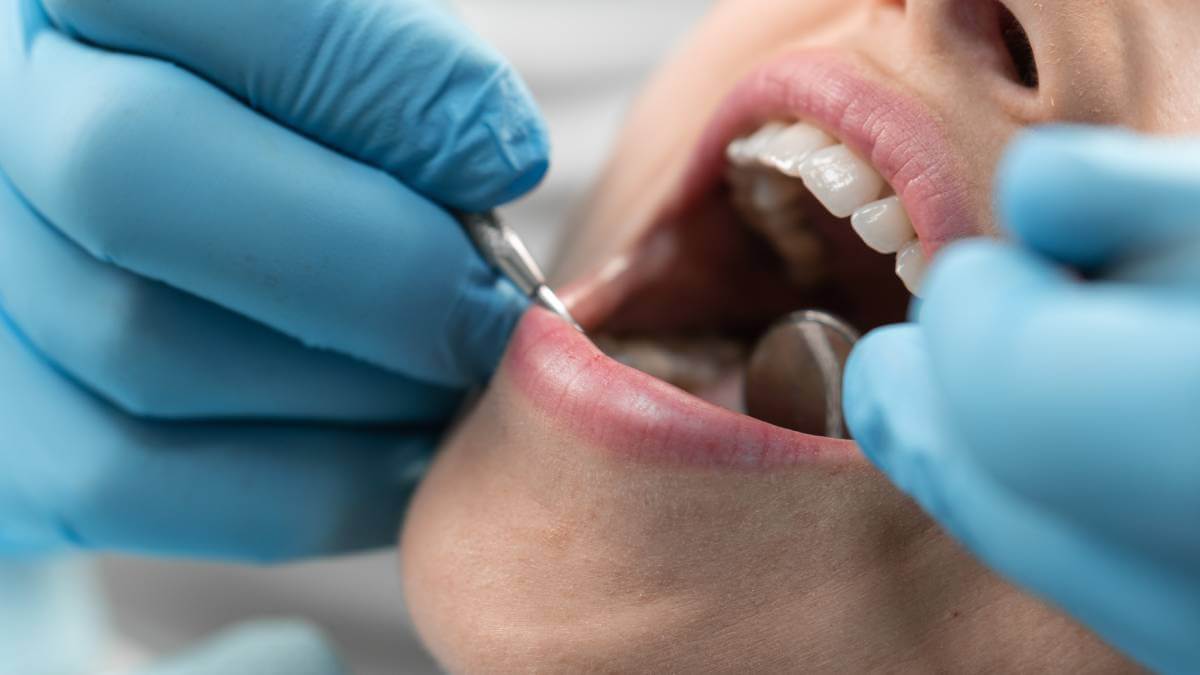 Teeth close up