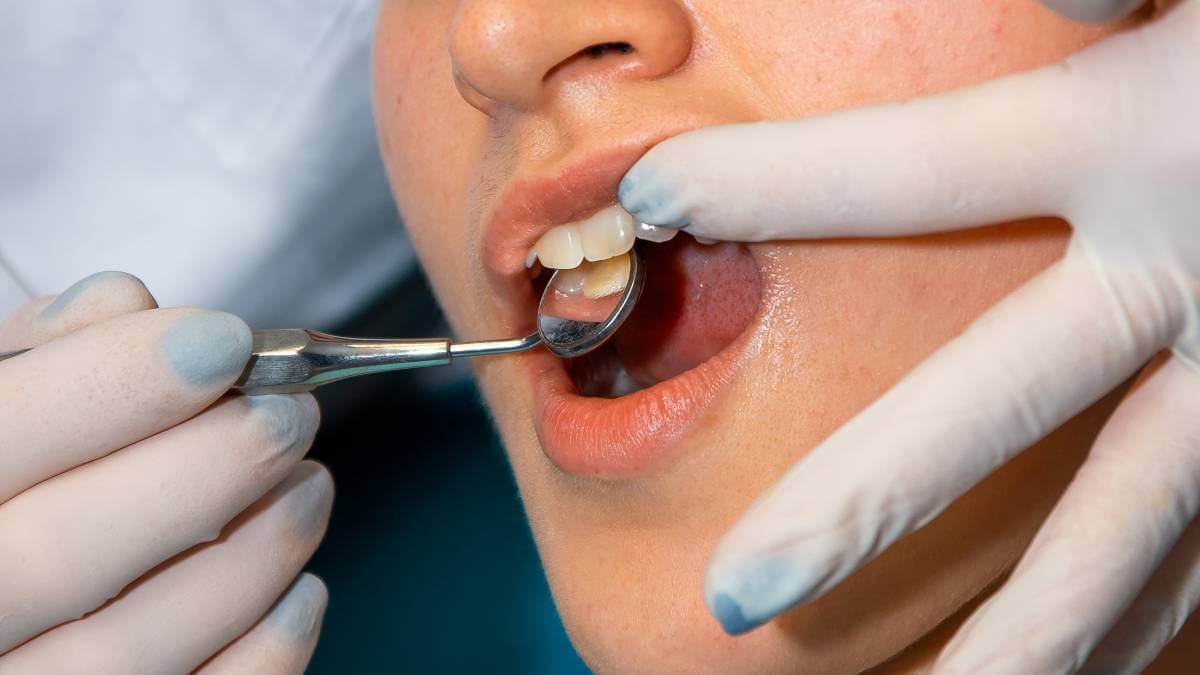 healthy teeth